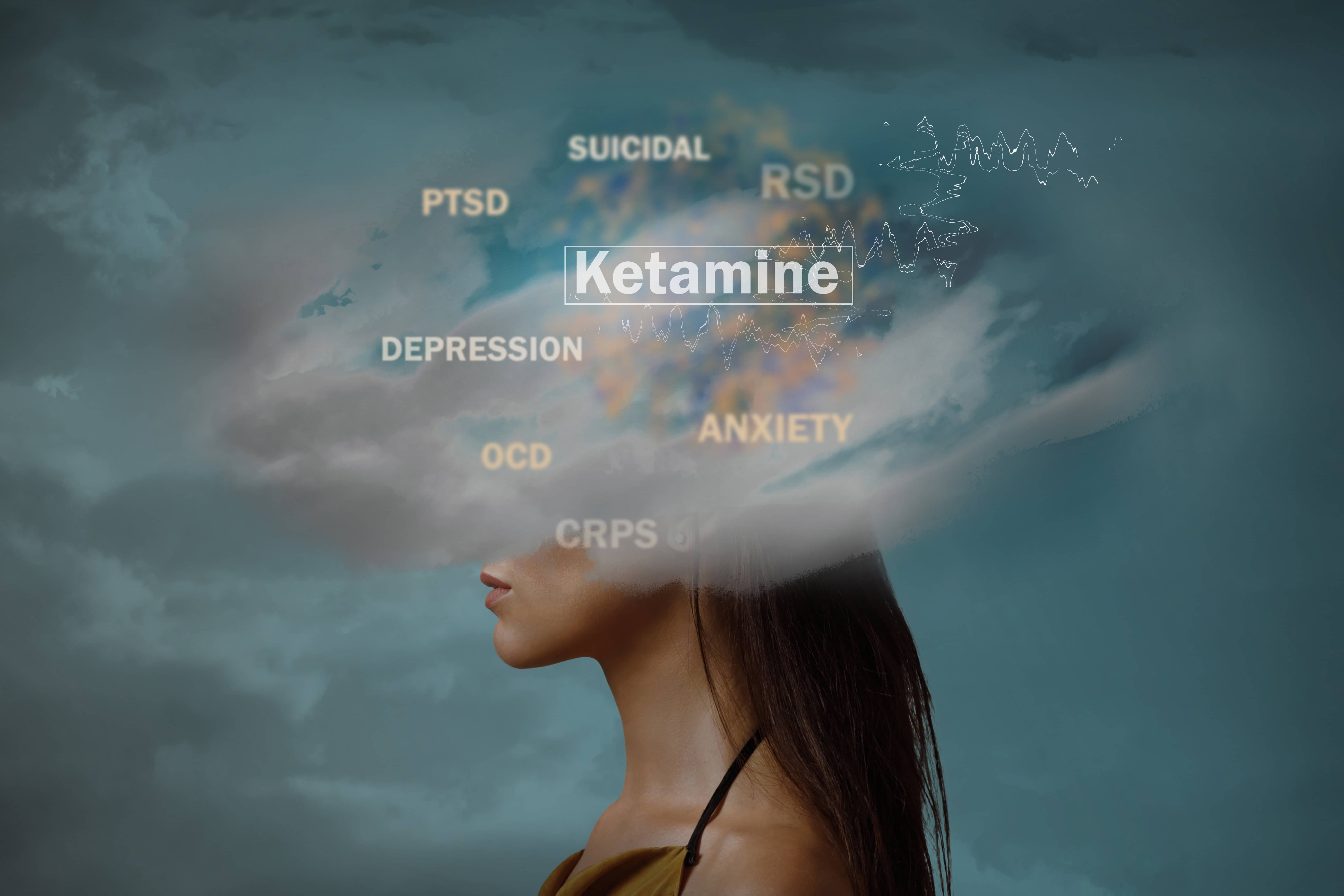 Ketamine Therapy for Mental Health